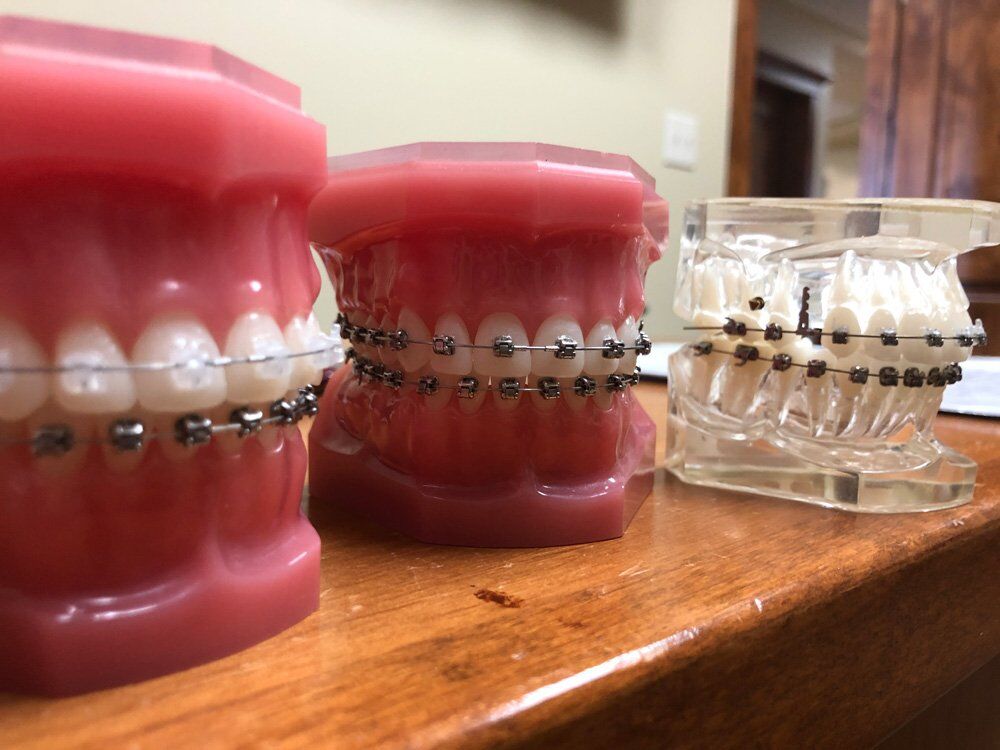 6 Ways To Tell If Your Bite Is Incorrect - Wilkinson Orthodontics